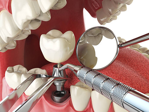 Best Tooth Infection Emergency Dentist  in Belgrade, MT